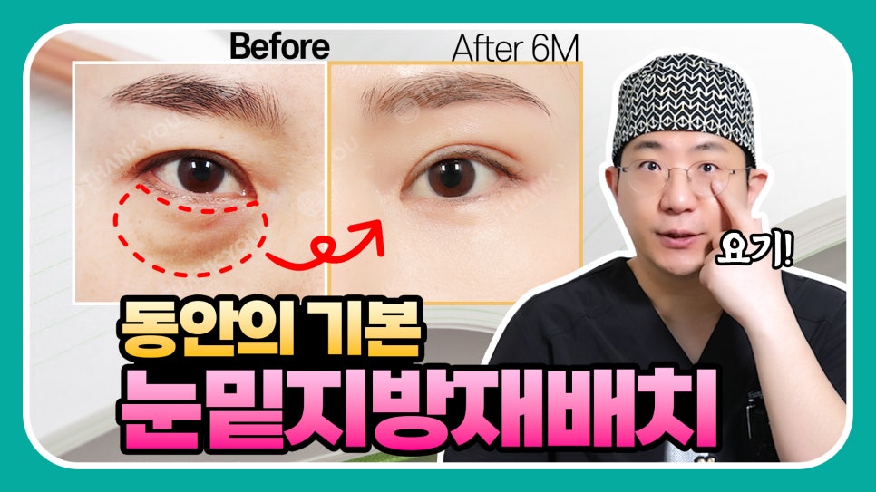 연예인 눈밑지방재배치?경결막과 눈물고랑이란? 관련 이미지 1