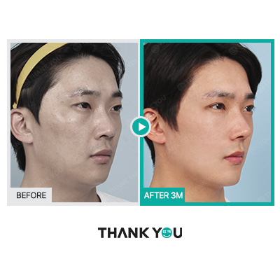 맥미남 배우, 확 달라진 변화? 남자성형외과는 THANK YOU! 관련 이미지 9