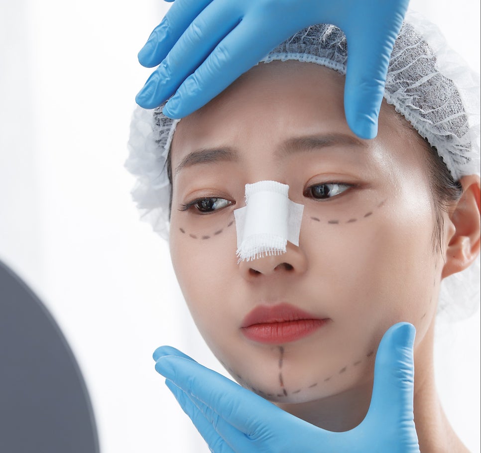 자가늑연골? 기증늑연골? 코성형수술 재료의 끝판왕? 관련 이미지 6