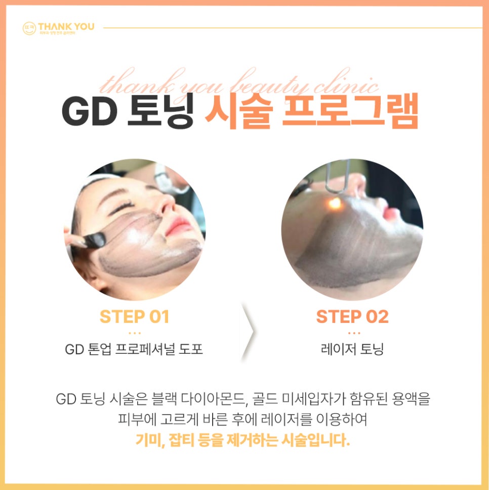 지디토닝 효과 :: 골드다이아 파티클로 미백, 필링 동시에 GD토닝 관련 이미지 5