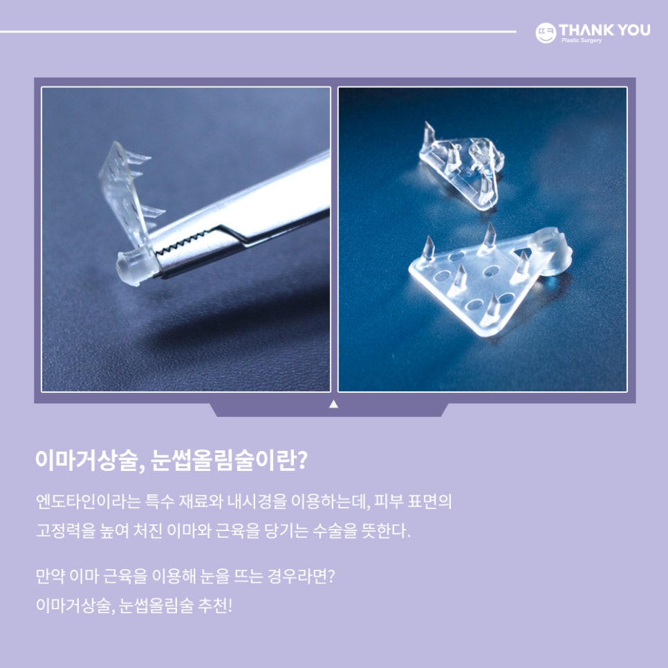 이마로 눈뜨기 개선하는 땡큐 눈썹올림술(거상술) 관련 이미지 1
