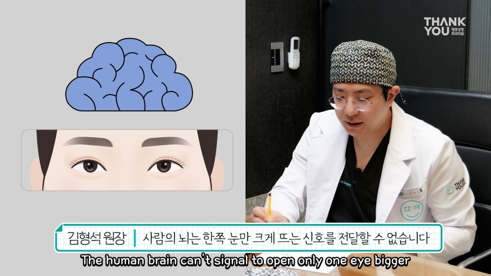비대칭눈 교정(짝짝이 쌍꺼풀) 헤링의 법칙이란? 관련 이미지 3