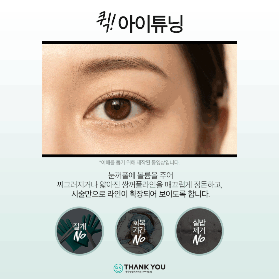 쌍꺼풀라인 절개 없이 확장하고 싶다면?! 땡큐 퀵!아이튜닝 관련 이미지 4