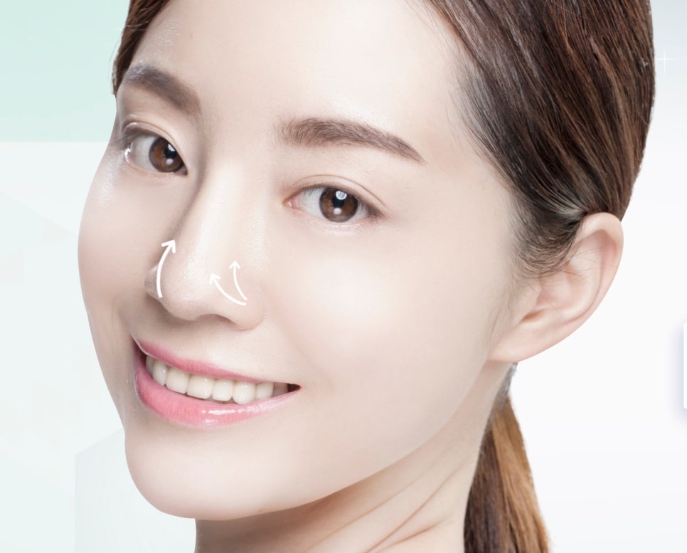 코 재수술시 기존 실리콘은 꼭 제거해야 되나요? 관련 이미지 2