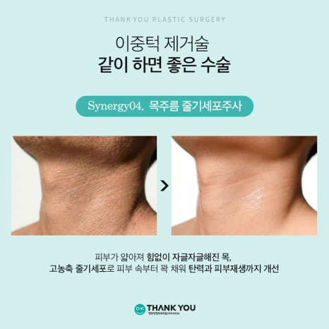 Not Enough Improvement from Chin Liposuction Alone? How About Thank You Double Chin Removal Surgery?! image 16