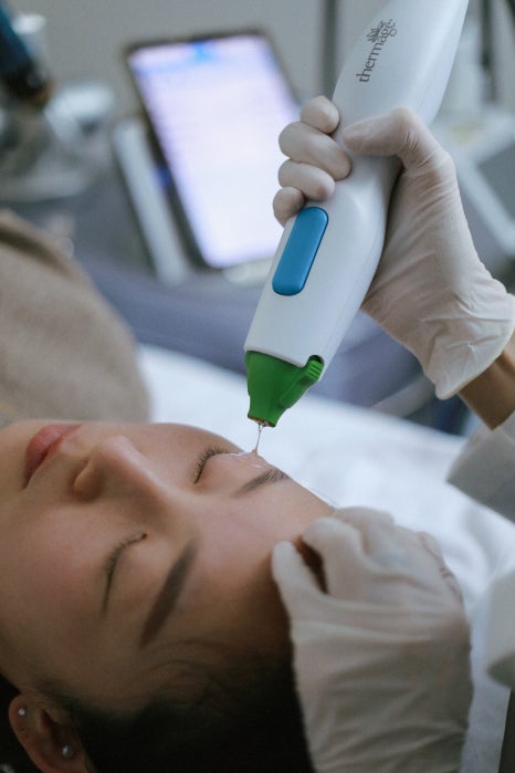 The Standard in Skin Lifting Devices, Thermage FLX &mdash; JM&rsquo;s Devices image 3