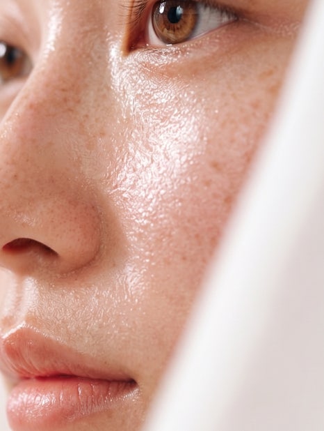 피부과 전문의가 매일 배우는 이유&mdash; 강남역피부과JM 지향하다. 관련 이미지 3