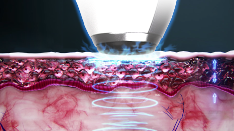 From Skin Firmness and Texture to Skin Condition Recovery— Corage Cell Fit — Gangnam Station Dermatology JM’s Devices image 10