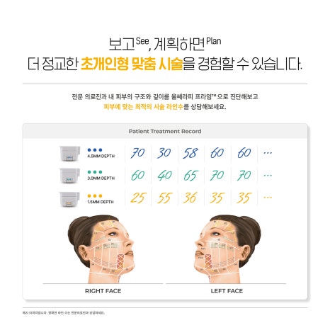 피부층을 정밀관찰하며 리프팅 울쎄라피 프라임 ULTHERA — JM’s Devices 관련 이미지 7