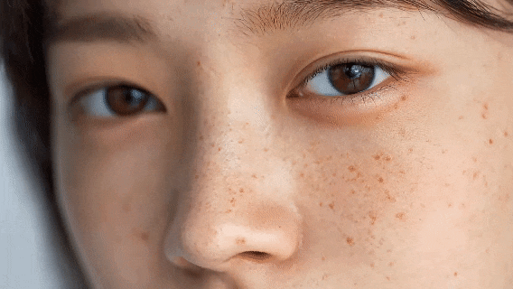 피부는 한 가지 해답으로 완성되지 않습니다.&mdash; 강남역피부과JM 지향하다. 관련 이미지 2