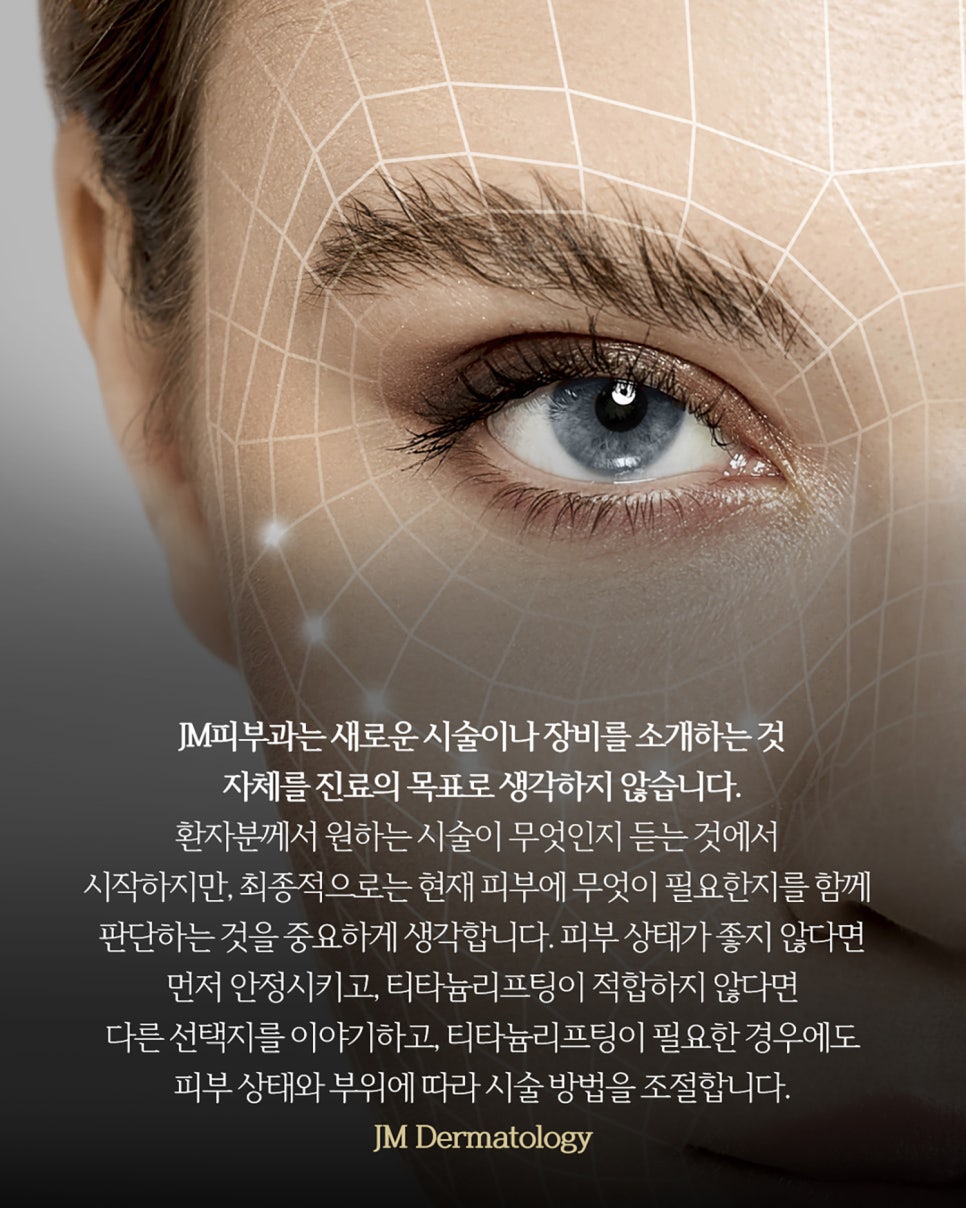 양재티타늄리프팅 같은시술을 받아도 결과가 다른이유 —JM지향하다. 관련 이미지 17