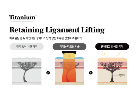 A Lifting Device That Considers Both Speed and Burden, Titanium Titanium &mdash; JM&rsquo;s Devices image 3