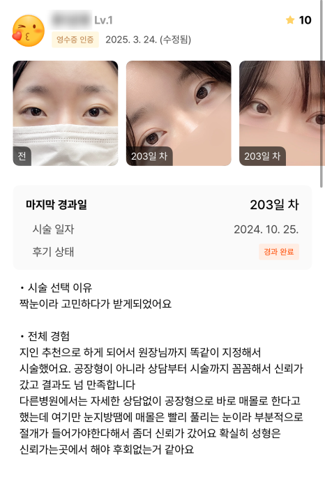 [Gangnam Station Yellow Plastic Surgery / Eye Surgery] Seven-Month Review After First Partial Incision Surgery: Improvement in Uneven Eyes image 2