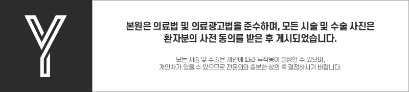 [ 강남역 옐로우성형외과 / 눈성형 ] 자연유착 윗트임 수술 후기 관련 이미지 13