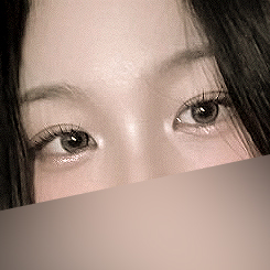 [ 강남역 옐로우성형외과 / 눈성형 ] 자연유착 윗트임 수술 후기 관련 이미지 5