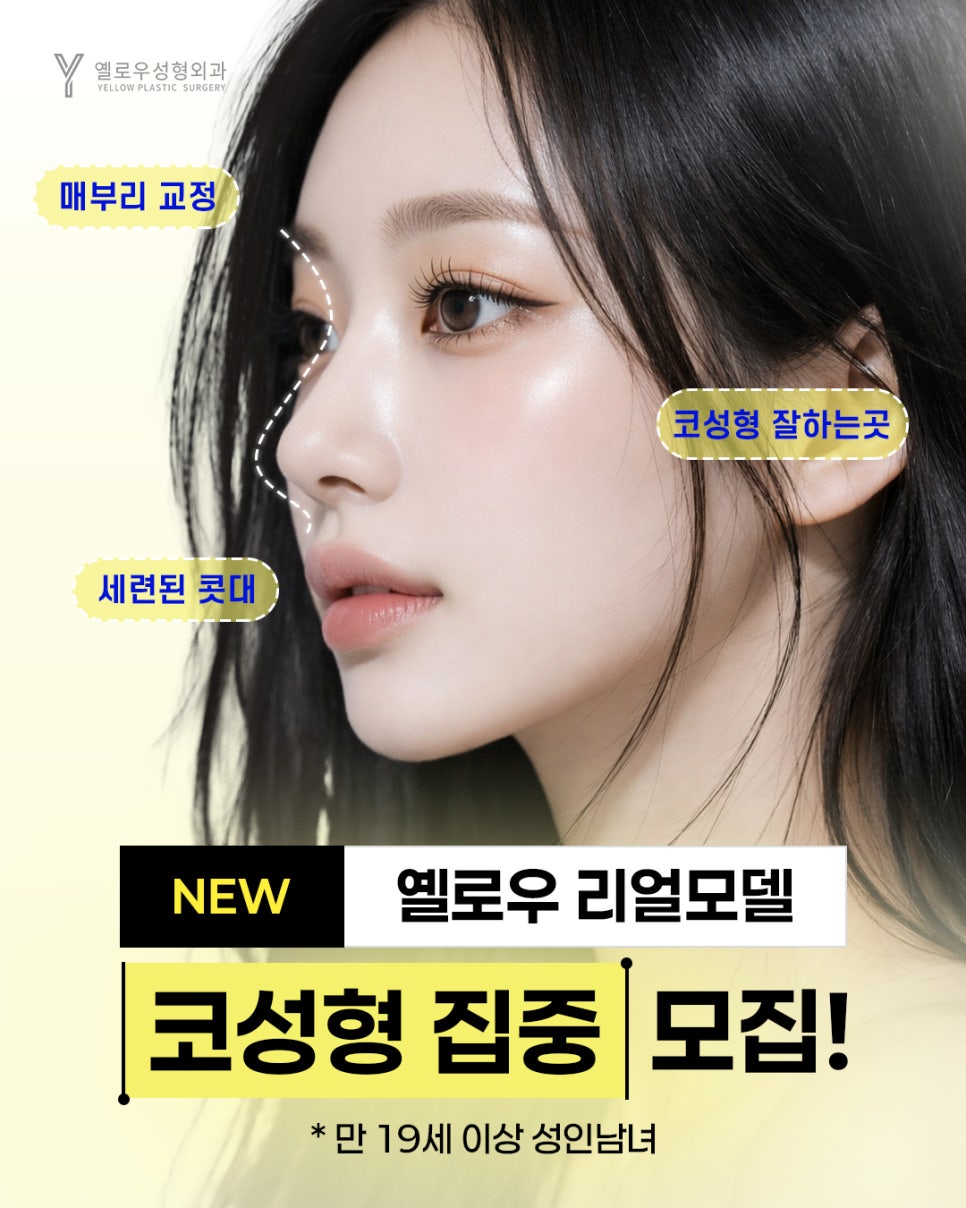 옐로우 코성형 리얼모델 모집 관련 이미지 1
