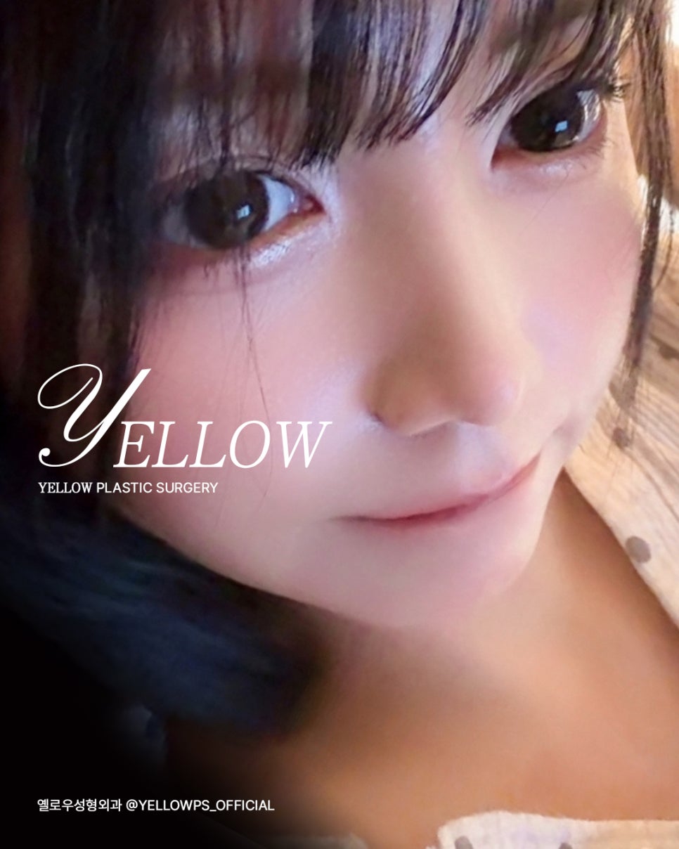 [ Gangnam Station Yellow Plastic Surgery / Eye Surgery ] Natural Adhesion + Upper Eyeline Incision image 2