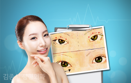 Information That Makes You Prettier When You Read It [Eye Surgery] image 4
