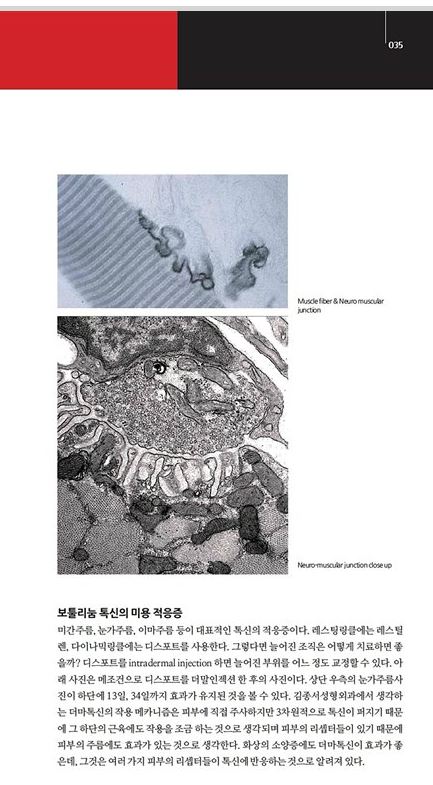 메디컬S 잡지 기사/ 보톡스 / 김종서성형외과원장 (디스포트,보톡스,주름,사각턱보톡스,종아리보톡스,승모근) 관련 이미지 3