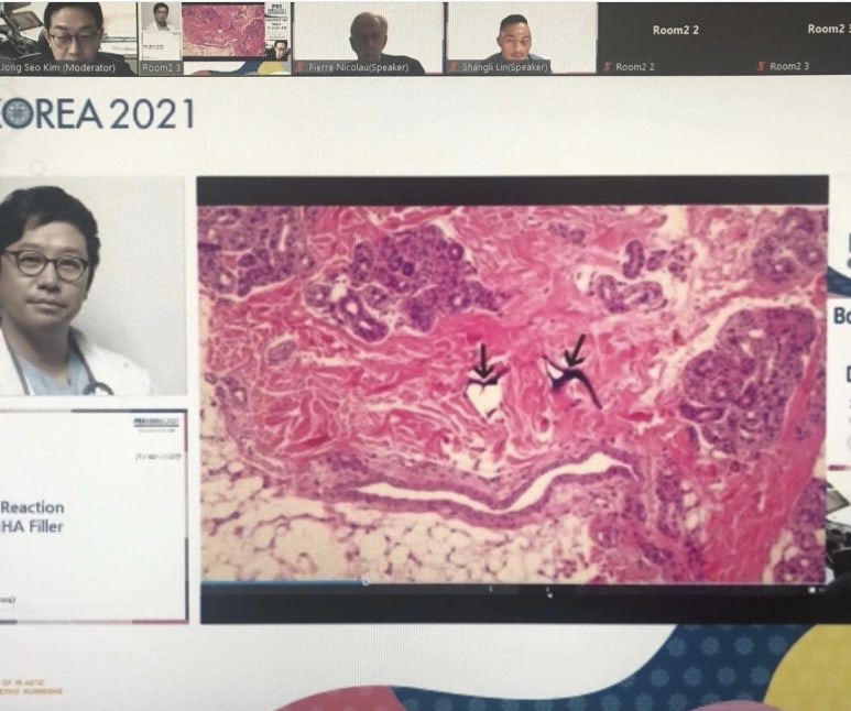 2021년 11월 14일  대한성형외과 학회 보톡스/필러/실리프팅 분야를 맡은 김종서성형외과 관련 이미지 7