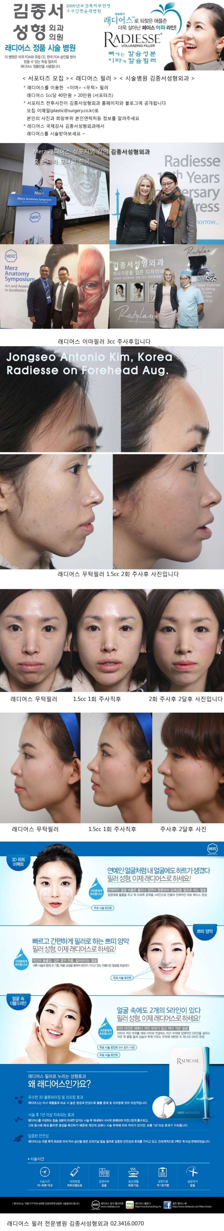 Recruiting Radiesse Supporters (50% Off Procedure Fee + Before-and-After Photos Provided) 200,000 KRW per 1 cc image 1