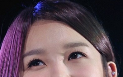 Lower Blepharoplasty at a Gangnam Plastic Surgery Clinic image 6