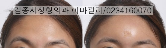 Click! Mini Plastic Surgery image 6