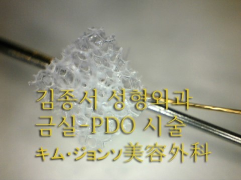 금실PDO매선 한국에서 세계최초 출시 / 김종서성형외과 금실-시술병원 선정 관련 이미지 2