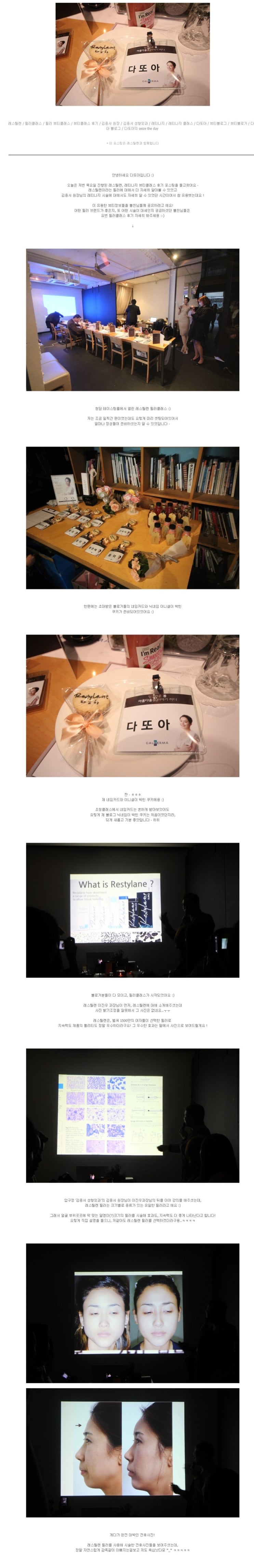 2014년3월27일 레스틸렌 필러, 레티나지 강의후기 - 다또아 관련 이미지 2