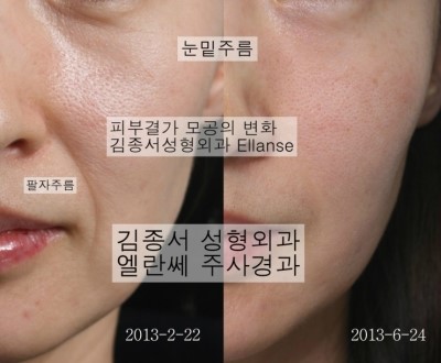 쁘띠성형, 찾으셨나요? 여기예요! 관련 이미지 10