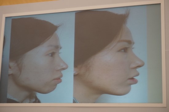 I Went to the Restylane 20 Million Treatment Commemoration Beauty Week image 24