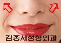 [주름제거시술] 엘라스틱리프팅으로 더욱 효과적인 주름제거를! <김종서 성형외과> 관련 이미지 3