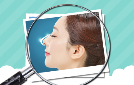 집중! 코성형 관련 이미지 7
