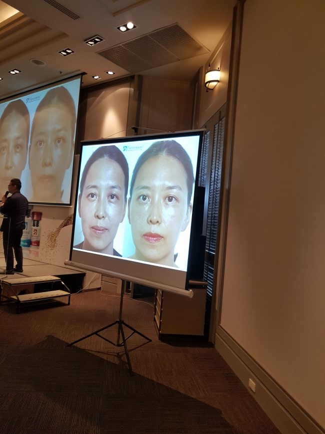 Medytoxin and Neuramis Seminar, Hands-On Workshop in Bangkok, Thailand image 9