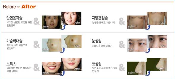 김종서성형외과 홈페이지 봄맞이 새단장♡ 관련 이미지 4