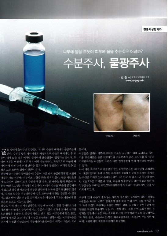 반짝반짝 물광피부엔 수분주사 관련 이미지 1