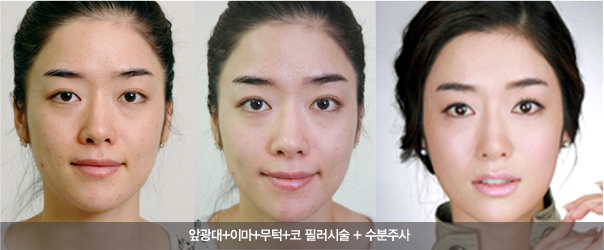 물광주사로 수분채워넣기! 관련 이미지 5