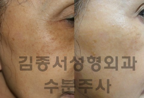 ANTI-AGING MEDICINE ASIAN CONGRESS (싱가폴 세계학회 발표/ 김종서성형외과원장 10월 25-27일 무려 3개 강의) 관련 이미지 5