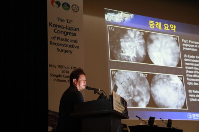2014년 5월 18일 송도 한일학회 레스틸렌물광(레티나지) 발표 관련 이미지 8