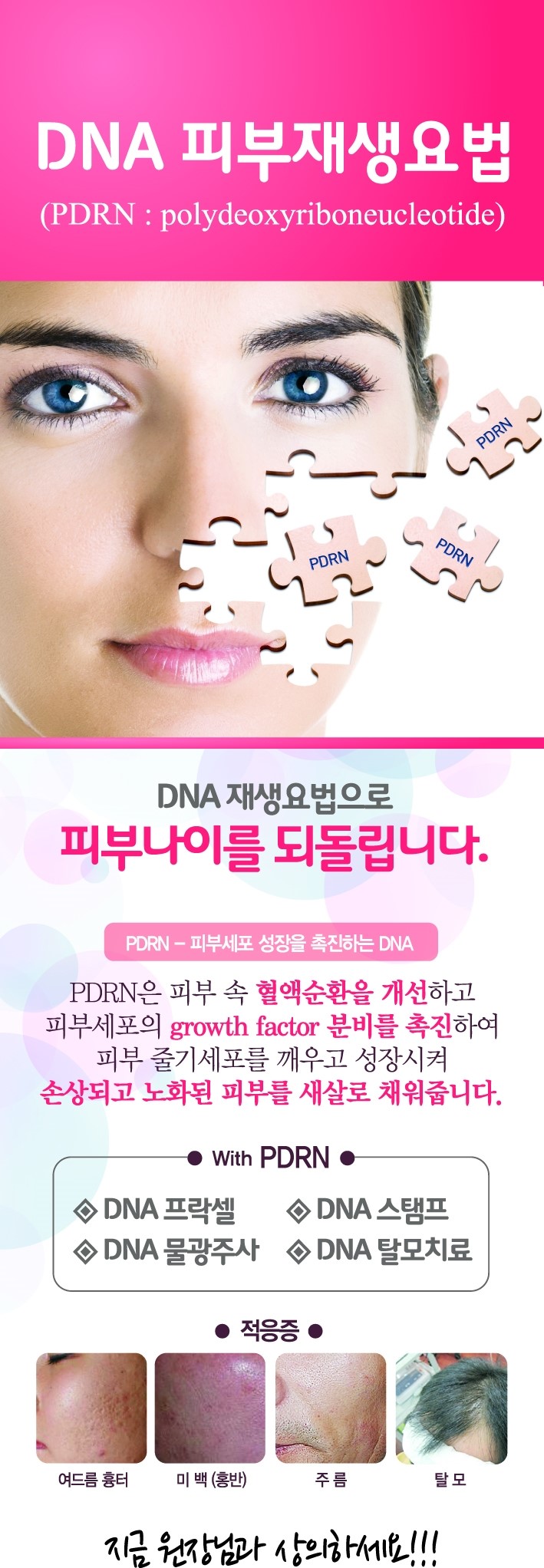 메조DNA (meso-DNA) 메조롤러용 연어핵산 화장품 / 독점판매 김종서성형외과 / 3명9만원, 1병4만원 관련 이미지 1