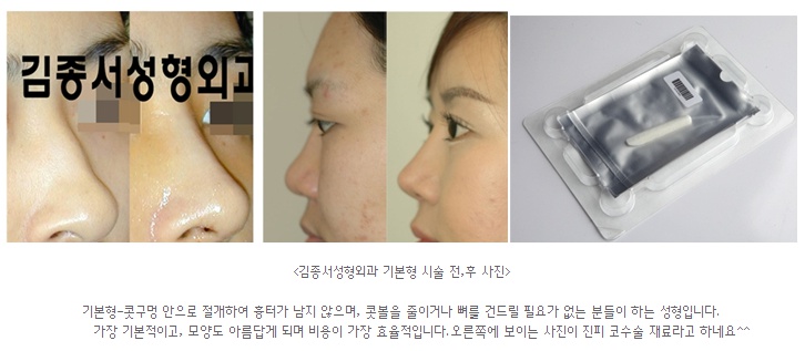 뷰티타임에 김종서성형외과가 소개되었어요♡ 관련 이미지 5