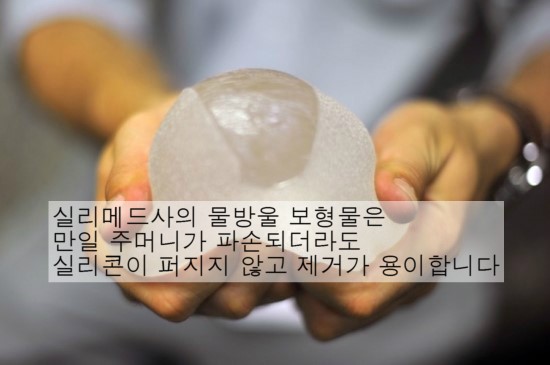 물방울 보형물 / 김종서성형외과 관련 이미지 4