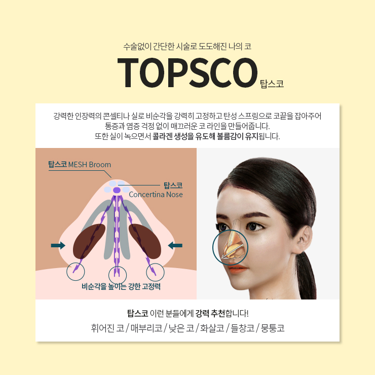 탑스코 ~간단한 시술로 콧대&middot;콧등&middot;콧대까지 한 번에!~ 관련 이미지 4