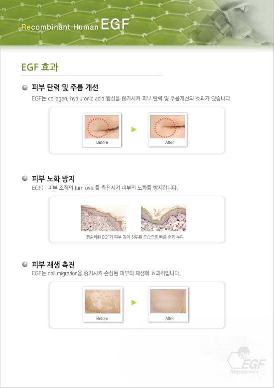 EGF란? 관련 이미지 3