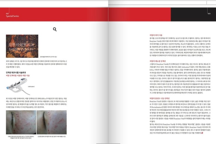 medical S 2013년 9월호 레스틸렌 비탈을 이용한 Dermal Hydration의 경험 관련 이미지 2