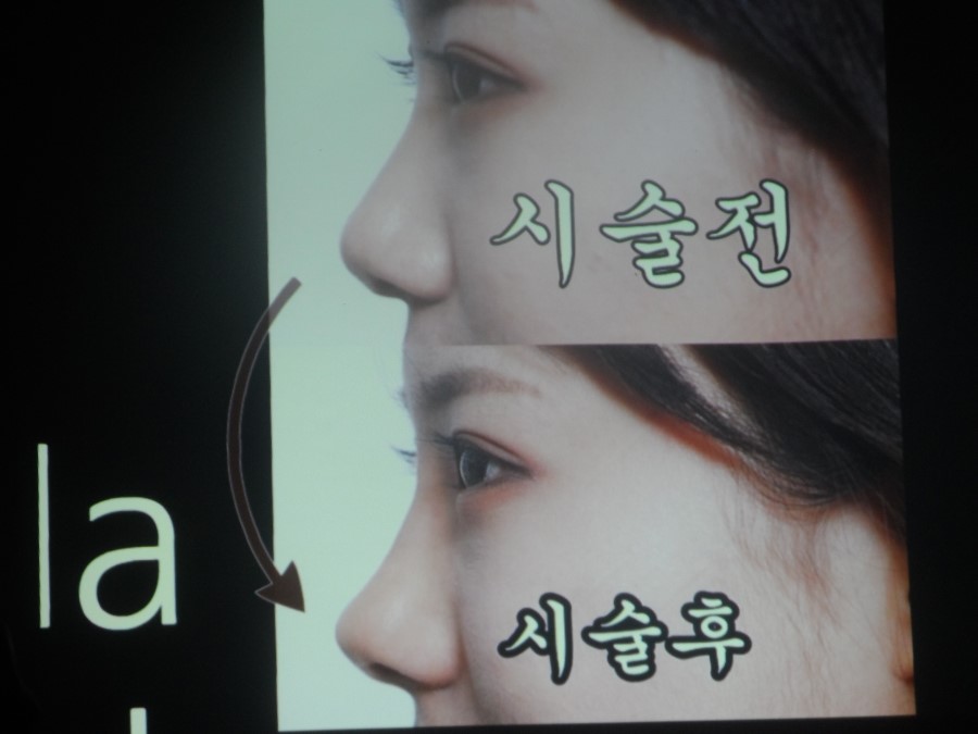 엘리님의 레스틸렌 (레티나지) 클라스 후기를 소개해드려요 ^^ 관련 이미지 26