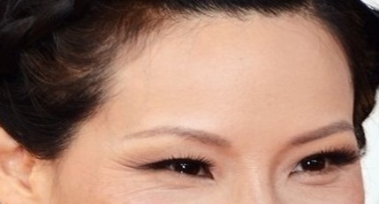 Forehead Wrinkle Removal - Restylane Forehead Filler, Han Go-eun Model Selection image 3