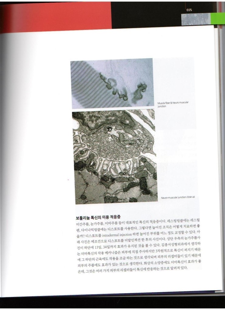 2013년 11월호 Medical에 김종서 원장님 "보툴리눔 톡신별 특징과 적응증"에 대한 기사가 실렸습니다. 관련 이미지 3