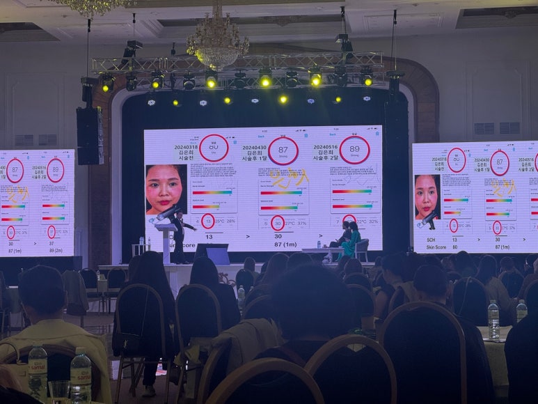 Lecture on Rejuran Seminar in Almaty, Kazakhstan! Official Collaboration News from Kim Jong-seo Plastic Surgery, Cell Fusion C, and Retinage image 6