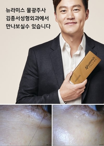 쁘띠성형 깨알 정복 관련 이미지 9